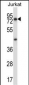 MCOLN1 Antibody (C-term)